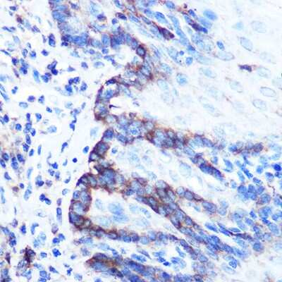 Immunohistochemistry-Paraffin: PDGFA Antibody [NBP3-05169] - Immunohistochemistry of paraffin-embedded Human esophagus using PDGFA antibody (NBP3-05169) at dilution of 1:100 (40x lens). Perform microwave antigen retrieval with 10 mM Tris/EDTA buffer pH 9.0 before commencing with IHC staining protocol.